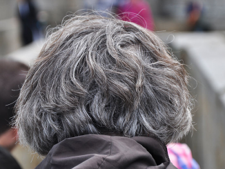 Grey Hair Causes At Young Age