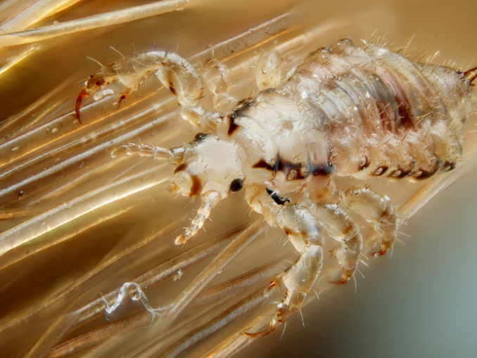 Natural Remedies For Lice