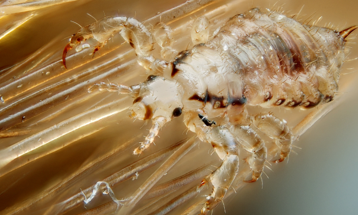 Natural Remedies For Lice